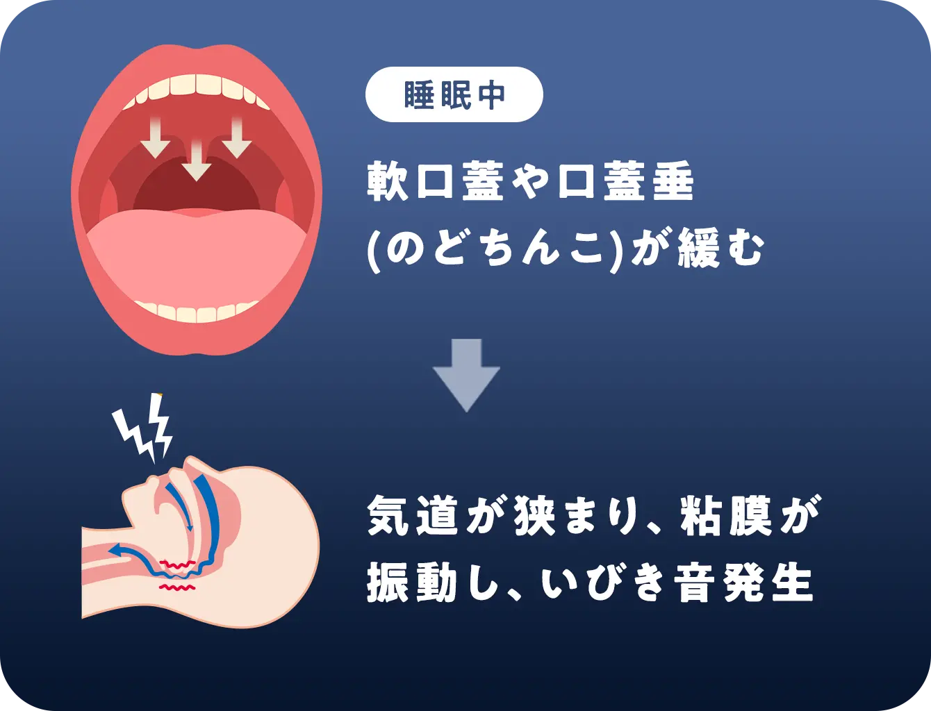 いびきの原因
